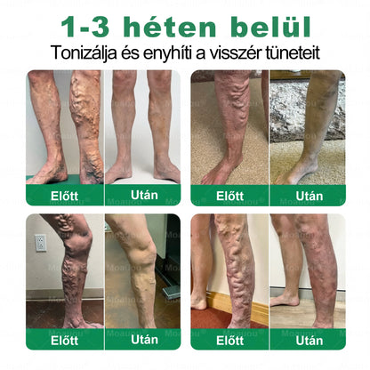 Moauou® Ércélzó Mikrotűs Tapasz ⚡ Azonnali enyhülés, hosszan tartó eredmények – NAGY AKCIÓ!