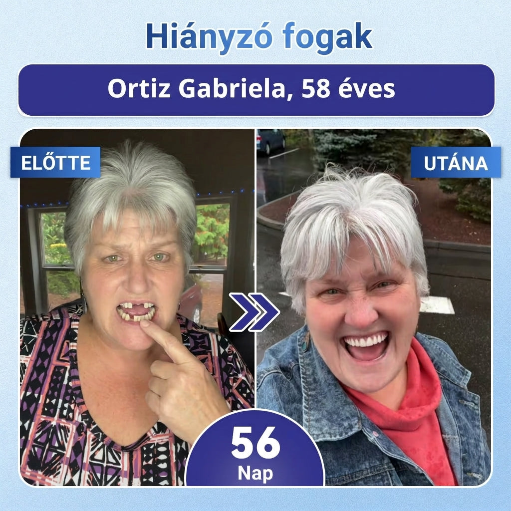 🎁 Coauoo® — Már csak 5 doboz maradt! Még egy további 50% kedvezményt is készítettünk Önnek! 💪 Lépjen be egy egészségesebb, tónusosabb mindennapi életbe. Kezdje el most – a következő lehetőség csak jövőre lesz!