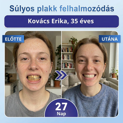 🎁 Coauoo® — Már csak 5 doboz maradt! Még egy további 50% kedvezményt is készítettünk Önnek! 💪 Lépjen be egy egészségesebb, tónusosabb mindennapi életbe. Kezdje el most – a következő lehetőség csak jövőre lesz!