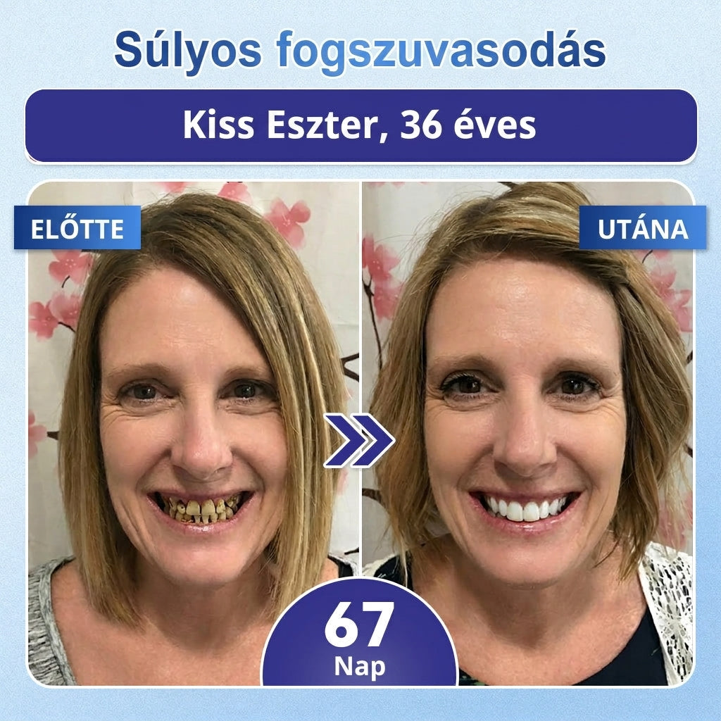 🎁 Coauoo® — Már csak 5 doboz maradt! Még egy további 50% kedvezményt is készítettünk Önnek! 💪 Lépjen be egy egészségesebb, tónusosabb mindennapi életbe. Kezdje el most – a következő lehetőség csak jövőre lesz!