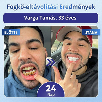 🎁 Coauoo® — Már csak 5 doboz maradt! Még egy további 50% kedvezményt is készítettünk Önnek! 💪 Lépjen be egy egészségesebb, tónusosabb mindennapi életbe. Kezdje el most – a következő lehetőség csak jövőre lesz!