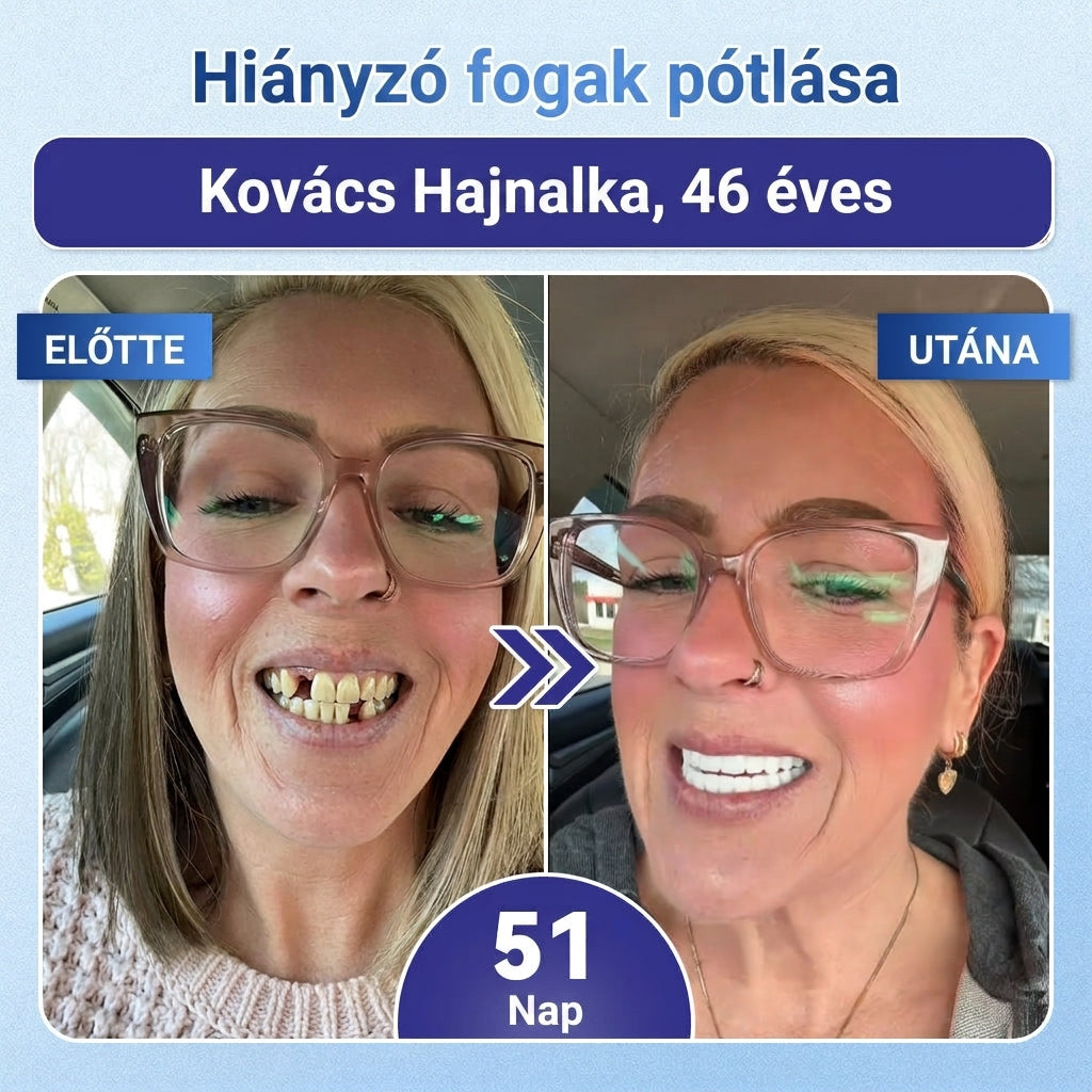 🎁 Coauoo® — Már csak 5 doboz maradt! Még egy további 50% kedvezményt is készítettünk Önnek! 💪 Lépjen be egy egészségesebb, tónusosabb mindennapi életbe. Kezdje el most – a következő lehetőség csak jövőre lesz!